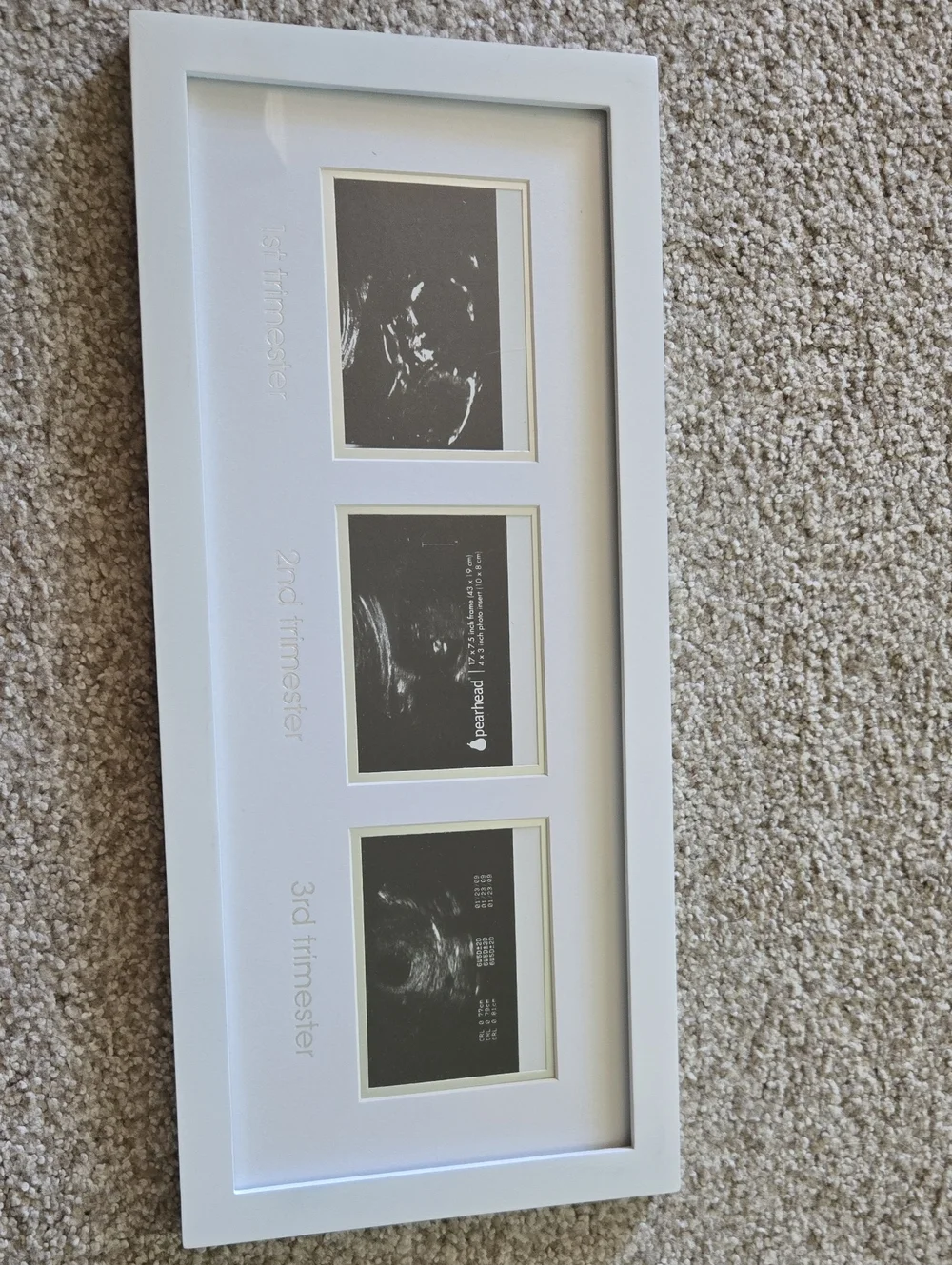 Ultrasound Photo Collage